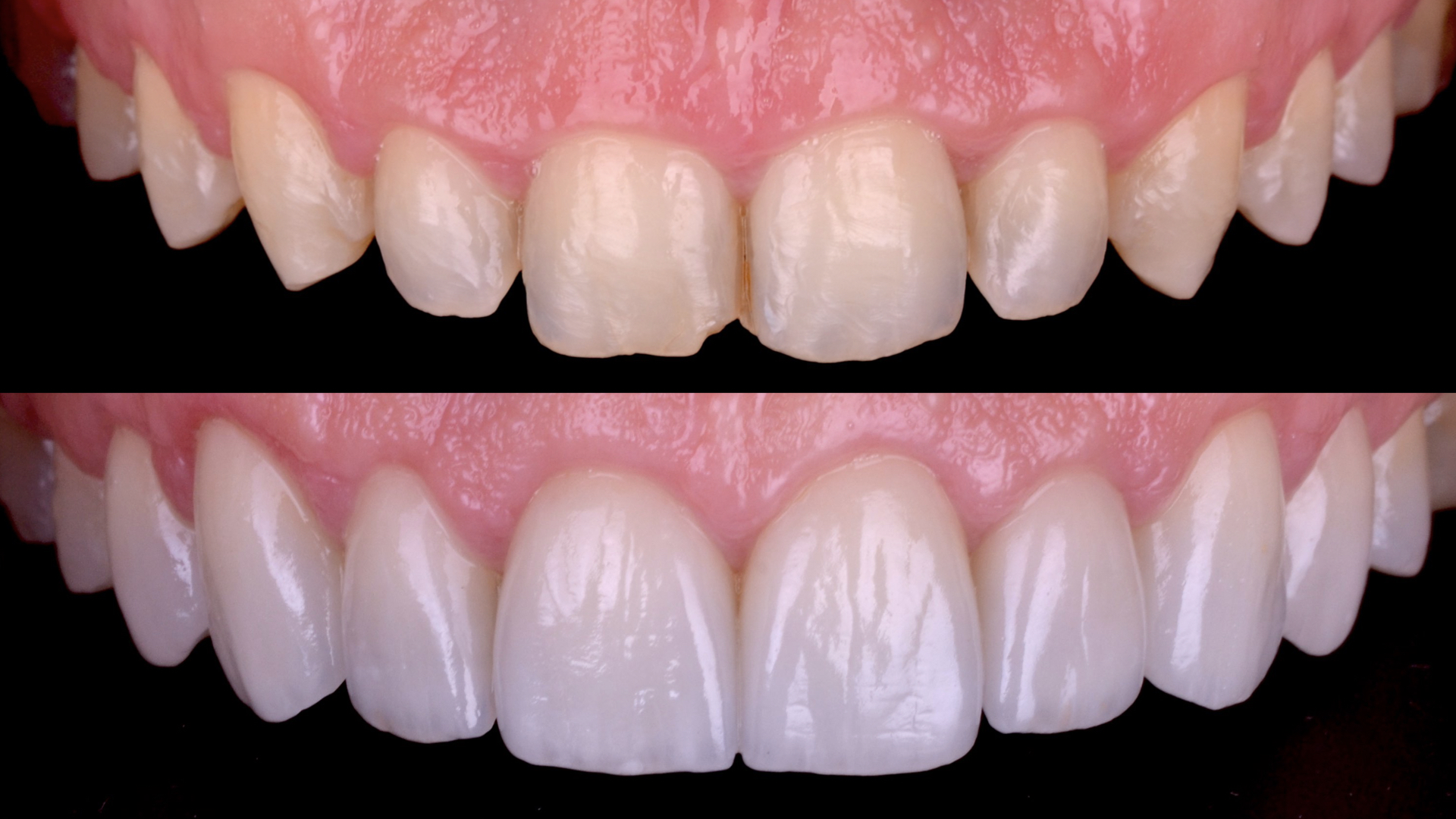 casos clinicos 212.001