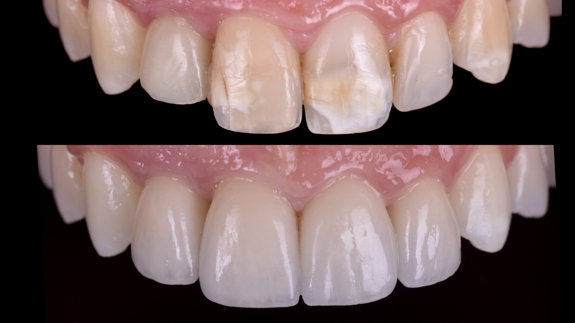 casos clinicos 212.004